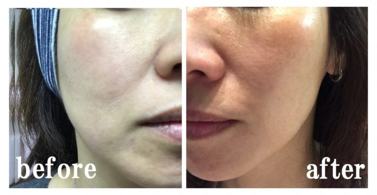 アンジュはノーファンデですが…～尾道エステブログ～アンジュ